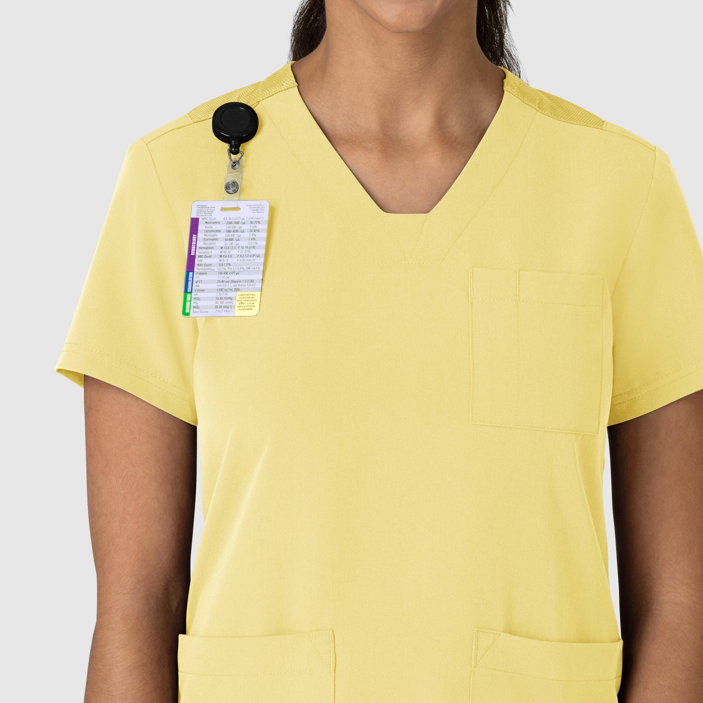 Nova 6132 Flex-n-Reach V-Neck Scrub Top Sunshine Yellow Model Image Alternate | Wink