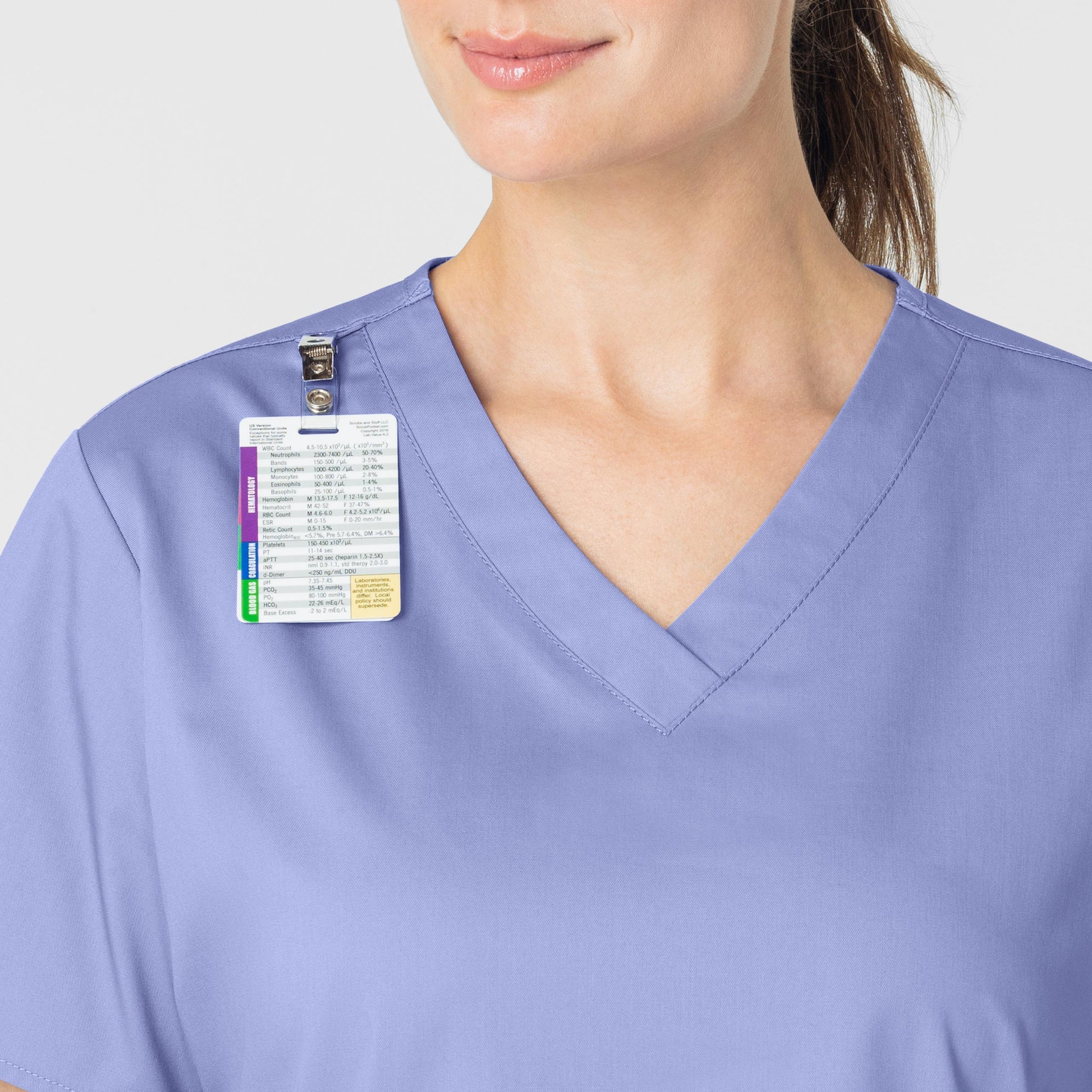 WonderWORK 101 V-Neck Scrub Top Ceil Blue Model Image Alternate | Wink